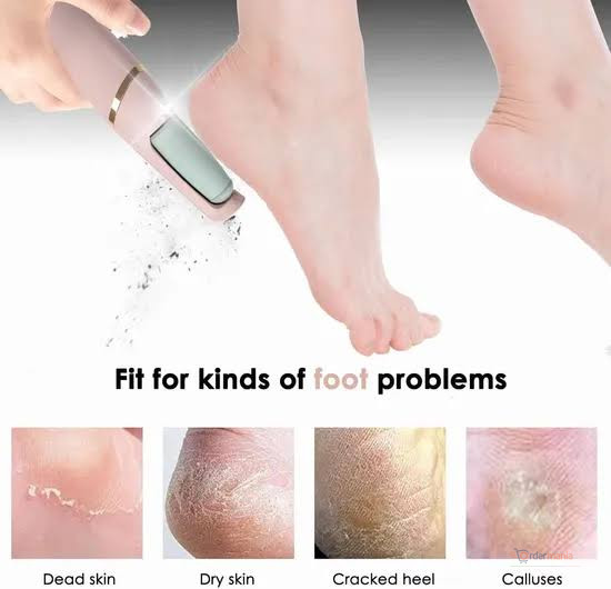 Electric Pedicure Foot File Callus Remover – Foot Care Tool